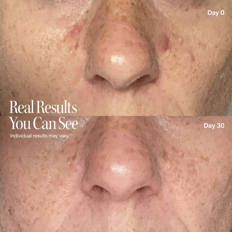 Red Light Therapy Mask